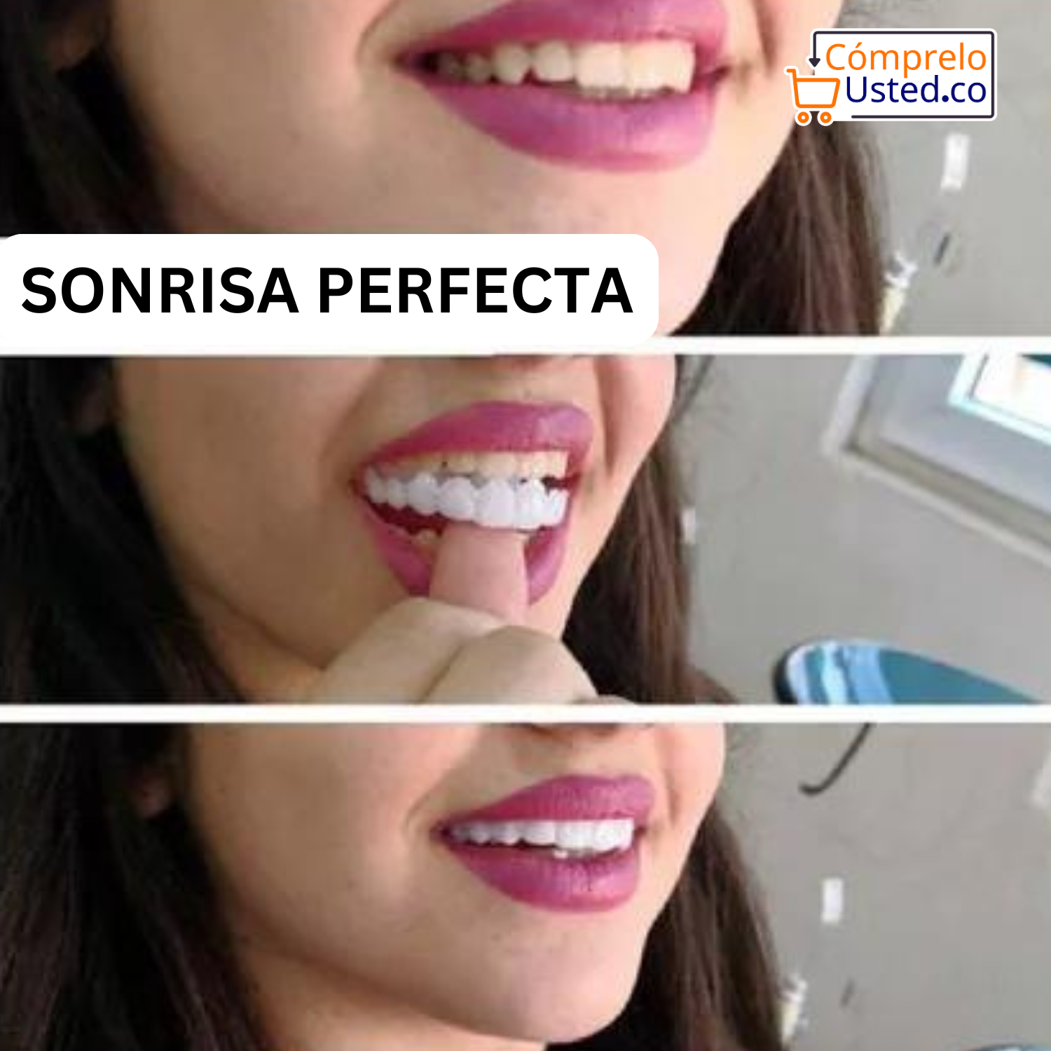 Carillas Dentales Faciles de Poner y Quitar